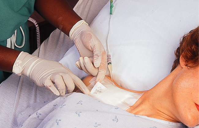 Piggyback system for intravenous therapy used in the hospital of the